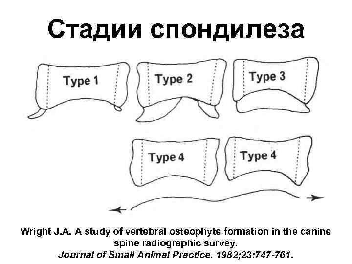 Стадии спондилеза Wright J. A. A study of vertebral osteophyte formation in the canine