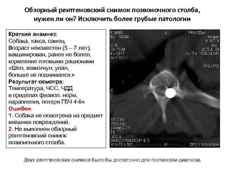 Обзорный рентгеновский снимок позвоночного столба, нужен ли он? Исключить более грубые патологии Краткий анамнез: