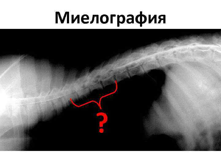 Миелография ? 