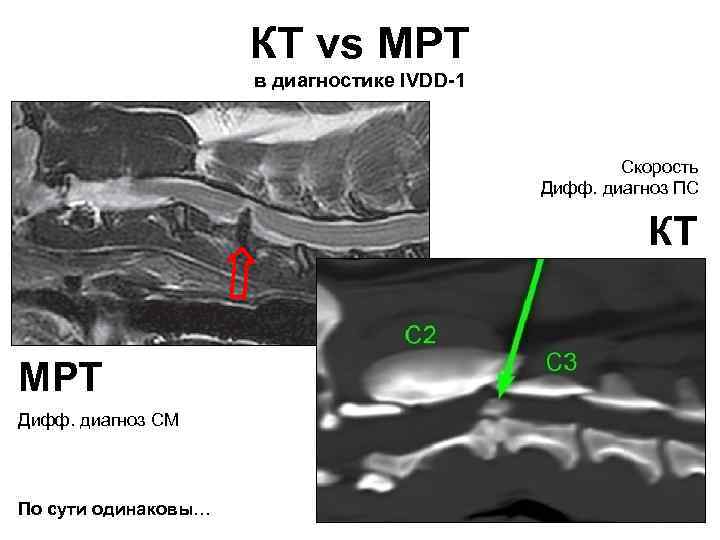 КТ vs МРТ в диагностике IVDD-1 Скорость Дифф. диагноз ПС КТ МРТ Дифф. диагноз