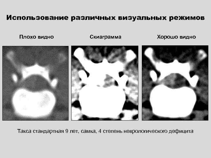 Использование различных визуальных режимов Плохо видно Скиаграмма Хорошо видно Такса стандартная 9 лет, самка,