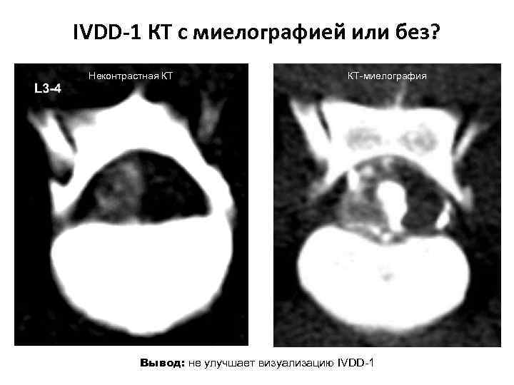 IVDD-1 КТ с миелографией или без? Неконтрастная КТ КТ-миелография Вывод: не улучшает визуализацию IVDD-1