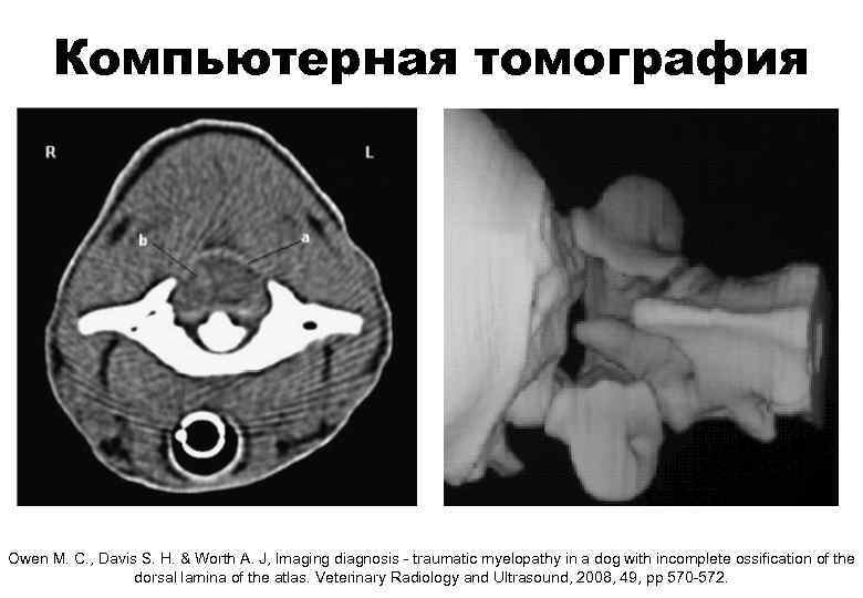 Компьютерная томография Owеn М. С. , Davis S. Н. & Worth А. J, lmaging