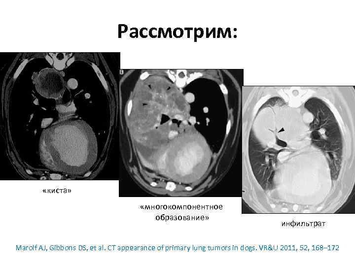 Рассмотрим: «киста» «многокомпонентное образование» инфильтрат Marolf AJ, Gibbons DS, et al. CT appearance of