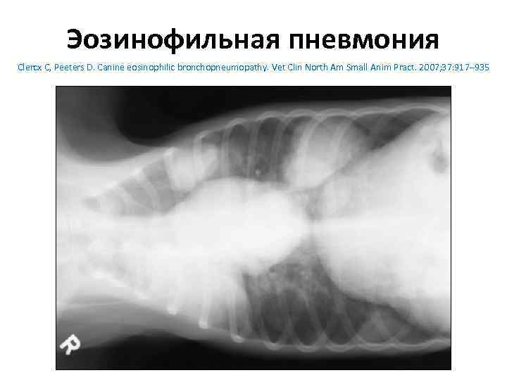 Эозинофильная пневмония Clercx C, Peeters D. Canine eosinophilic bronchopneumopathy. Vet Clin North Am Small