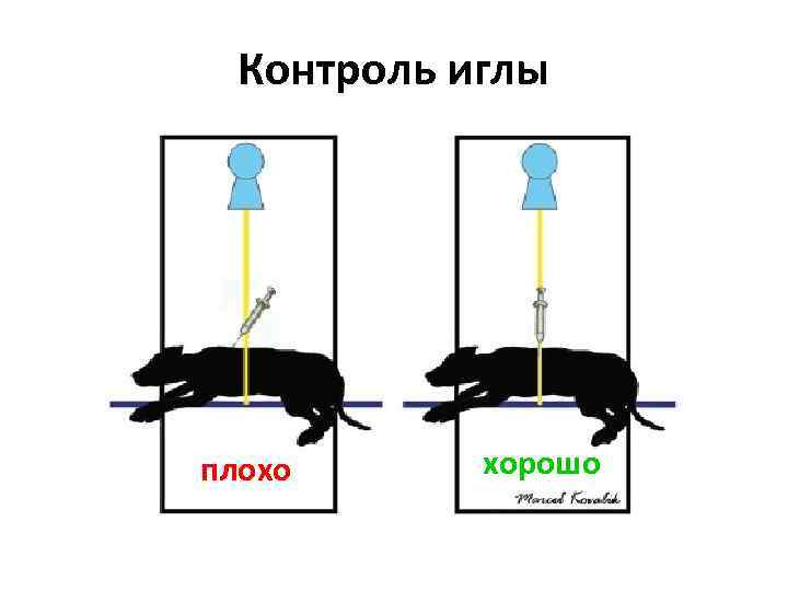 Контроль иглы плохо хорошо 