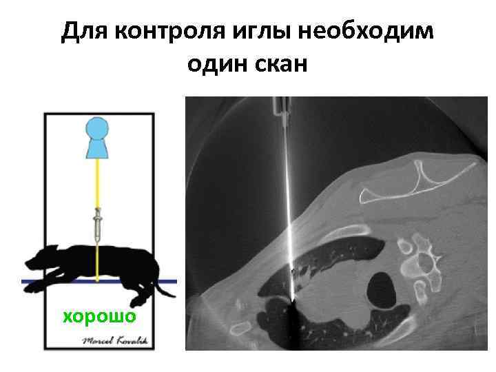 Для контроля иглы необходим один скан хорошо 