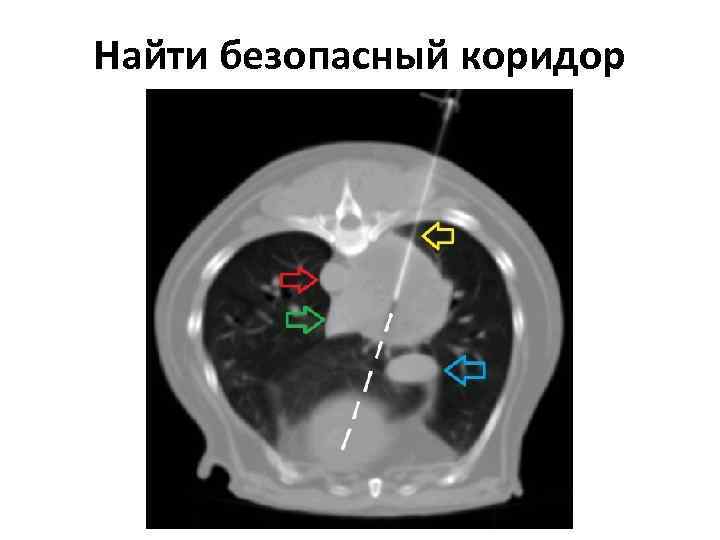 Найти безопасный коридор 