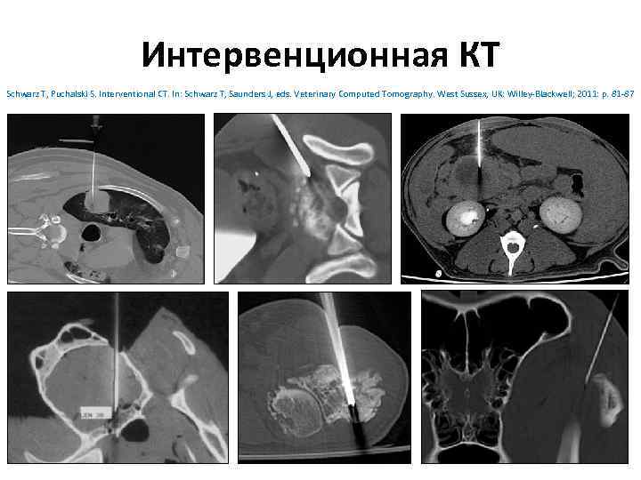 Интервенционная КТ Schwarz T, Puchalski S. Interventional CT. In: Schwarz T, Saunders J, eds.