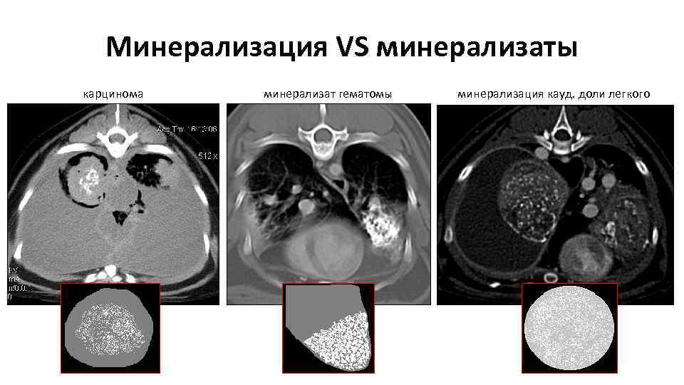 Кт картина гепатомегалии