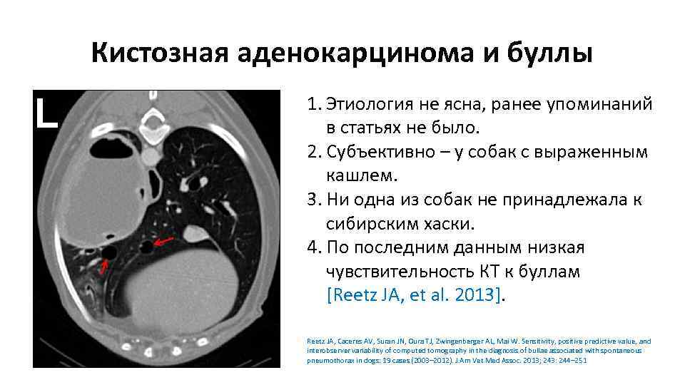 Кистозная аденокарцинома и буллы 1. Этиология не ясна, ранее упоминаний в статьях не было.