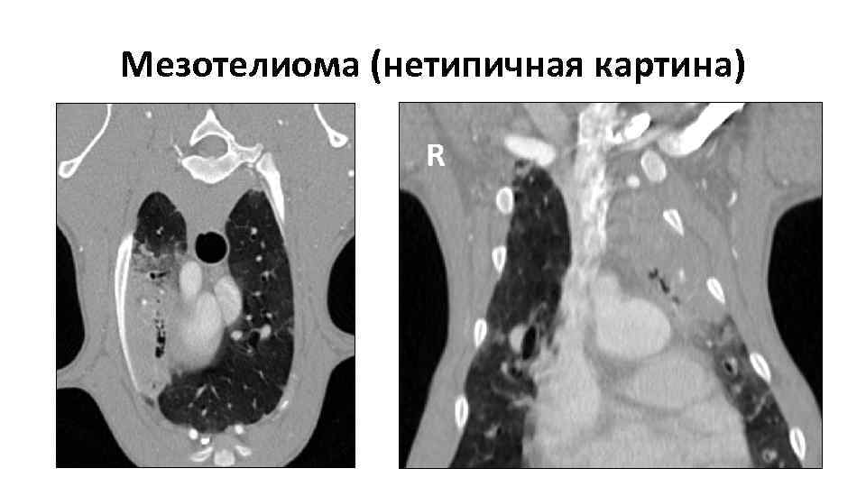 Кт картина долихосигмы это