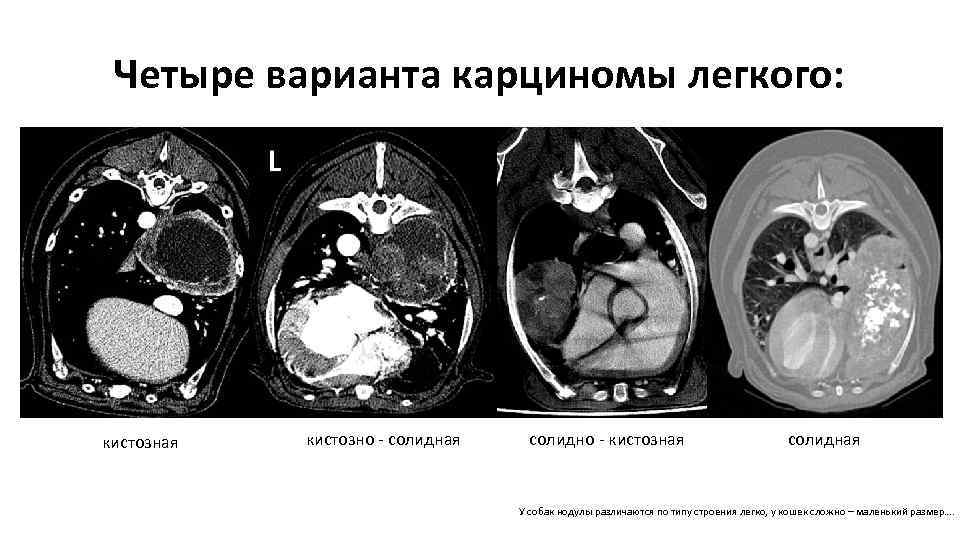 Четыре варианта карциномы легкого: кистозная кистозно - солидная солидно - кистозная солидная У собак