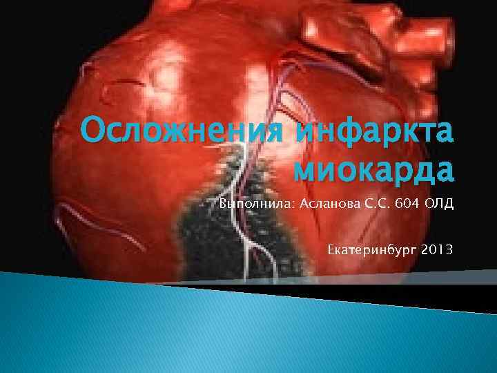 Осложнения инфаркта миокарда Выполнила: Асланова С. С. 604 ОЛД Екатеринбург 2013 