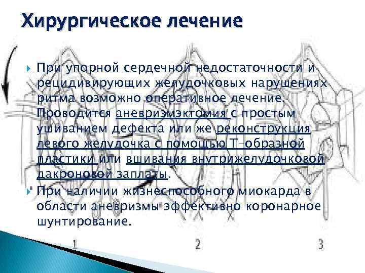 Хирургическое лечение При упорной сердечной недостаточности и рецидивирующих желудочковых нарушениях ритма возможно оперативное лечение.