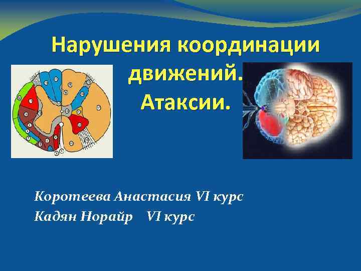 Нарушение координации движения. Нарушение движения. Расстройство координации движений. Координация движений нарушена. Лекарство от координации движения.