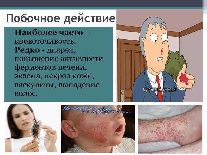 Побочное действие • Наиболее часто - кровоточивость. Редко - диарея, повышение активности ферментов печени,