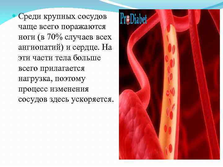 Среди крупных сосудов чаще всего поражаются ноги (в 70% случаев всех ангиопатий) и