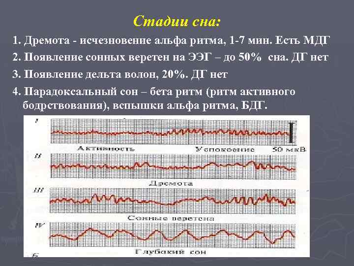 Стадии сна: 1. Дремота - исчезновение альфа ритма, 1 -7 мин. Есть МДГ 2.