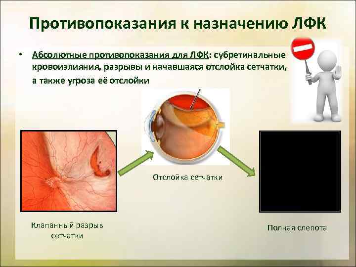 Противопоказания к назначению ЛФК • Абсолютные противопоказания для ЛФК: субретинальные кровоизлияния, разрывы и начавшаяся