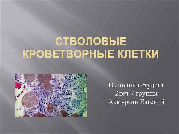 Кроветворную функцию выполняет. Стволовые кроветворные клетки. Гемопоэтические стволовые клетки под микроскопом. Стволовые кроветворные клетки находятся в. Гемопоэтические (кроветворные) стволовые клетки (ГСК).