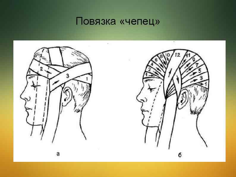 Повязка чепец рисунок