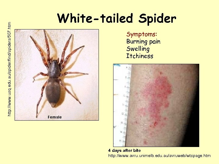 http: //www. usq. edu. au/spider/find/spiders/507. htm White-tailed Spider Symptoms: Burning pain Swelling Itchiness 4