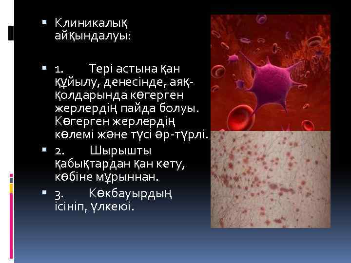  Клиникалық айқындалуы: 1. Тері астына қан құйылу, денесінде, аяққолдарында көгерген жерлердің пайда болуы.