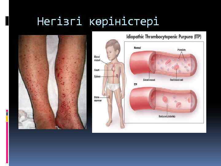 Негізгі көріністері 