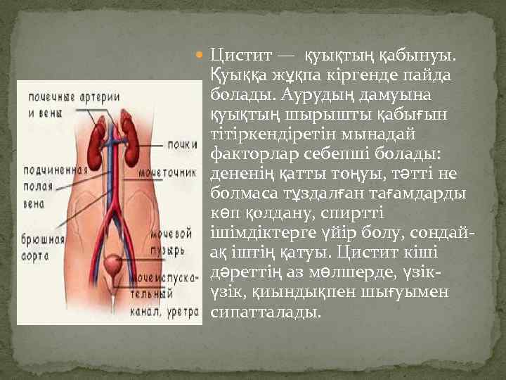  Цистит — қуықтың қабынуы. Қуыққа жұқпа кіргенде пайда болады. Аурудың дамуына қуықтың шырышты