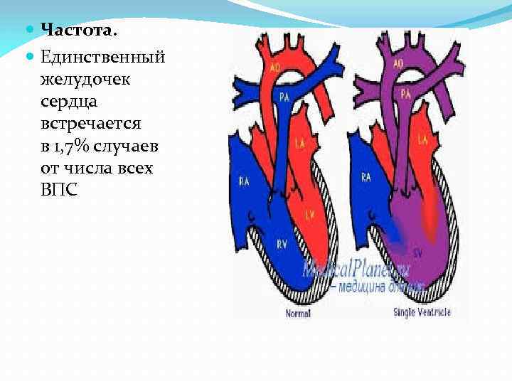 Единственный желудочек сердца клинические рекомендации нмо