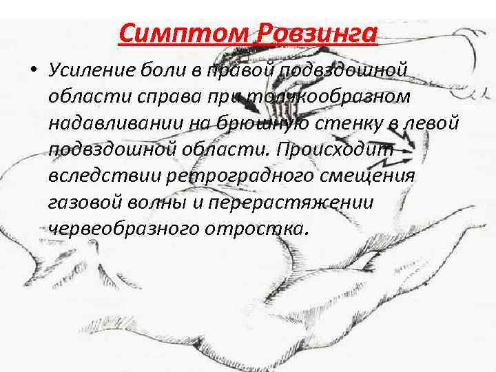 Симптом Ровзинга • Усиление боли в правой подвздошной области справа при толчкообразном надавливании на