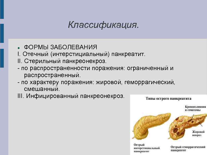 Классификация. ФОРМЫ ЗАБОЛЕВАНИЯ I. Отечный (интерстициальный) панкреатит. II. Стерильный панкреонекроз. по распространенности поражения: ограниченный