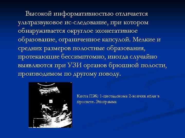 Высокой информативностью отличается ультразвуковое ис-следование, при котором обнаруживается округлое эхонегативное образование, ограниченное капсулой. Мелкие