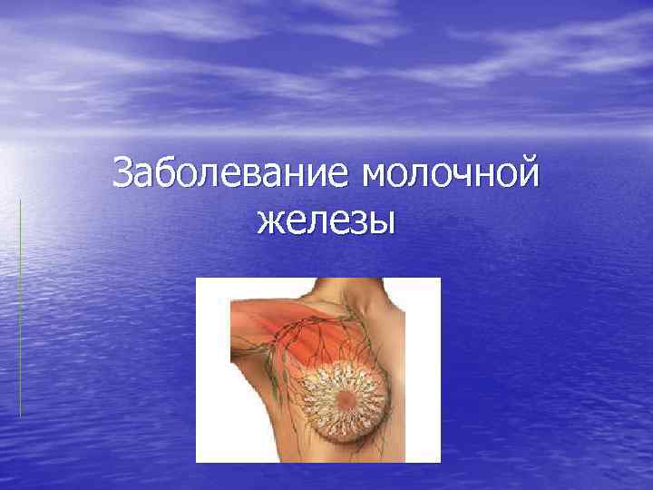 Заболевание молочной железы 