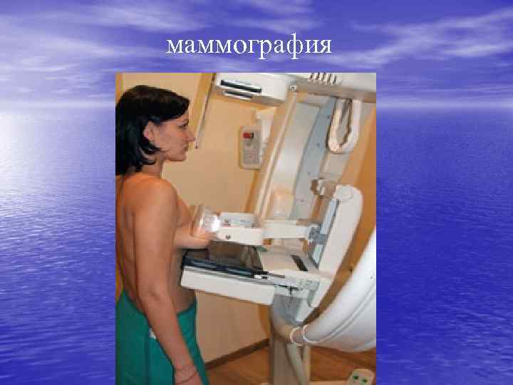 маммография 