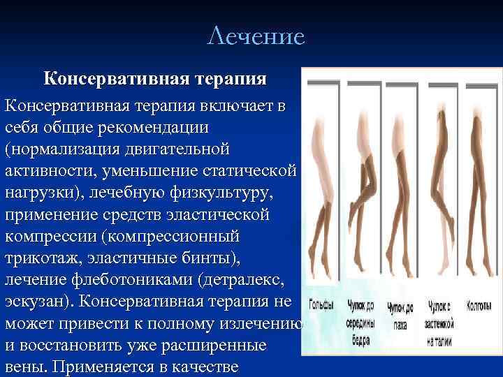 Варикозное расширение вен нижних конечностей фотографии