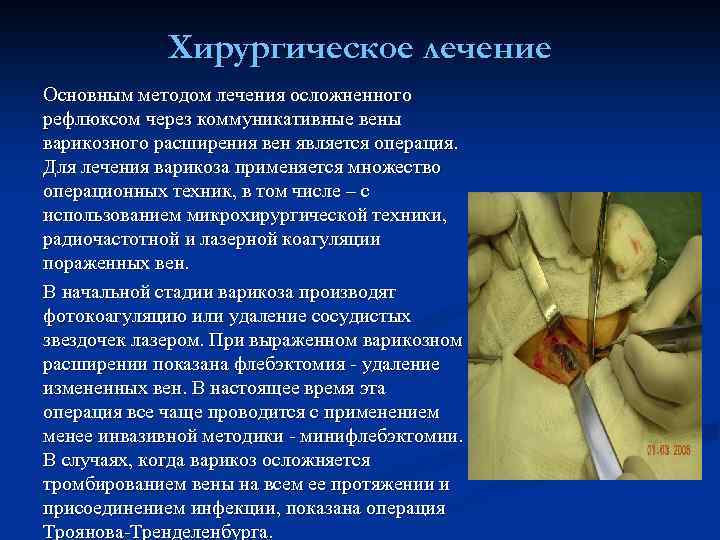Хирургическое лечение Основным методом лечения осложненного рефлюксом через коммуникативные вены варикозного расширения вен является