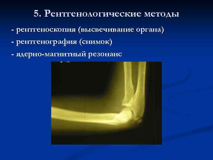 5. Рентгенологические методы - рентгеноскопия (высвечивание органа) - рентгенография (снимок) - ядерно-магнитный резонанс 