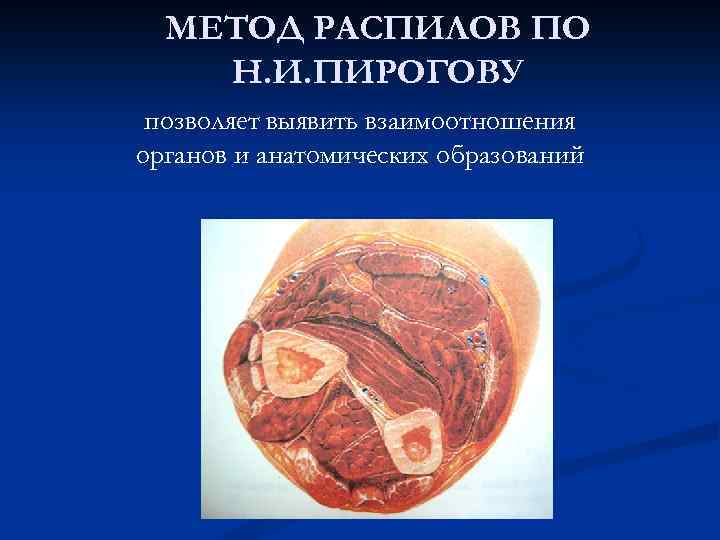 МЕТОД РАСПИЛОВ ПО Н. И. ПИРОГОВУ позволяет выявить взаимоотношения органов и анатомических образований 