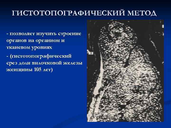 ГИСТОТОПОГРАФИЧЕСКИЙ МЕТОД - позволяет изучить строение органов на органном и тканевом уровнях - (гистотопографический