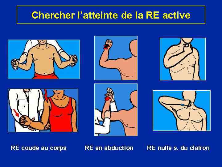 Chercher l’atteinte de la RE active RE coude au corps RE en abduction RE
