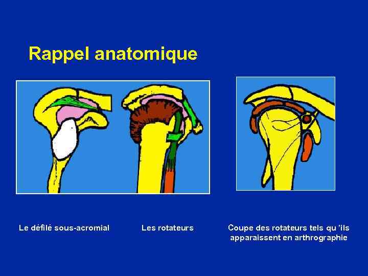 Rappel anatomique Le défilé sous-acromial Les rotateurs Coupe des rotateurs tels qu ’ils apparaissent