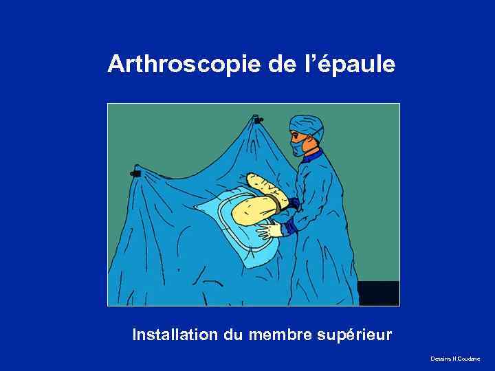 Arthroscopie de l’épaule Installation du membre supérieur Dessins H Coudane 