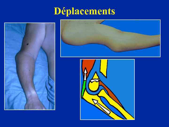 Déplacements 