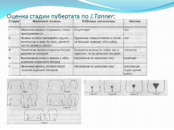 Оценка стадии пубертата по J. Tanner: 