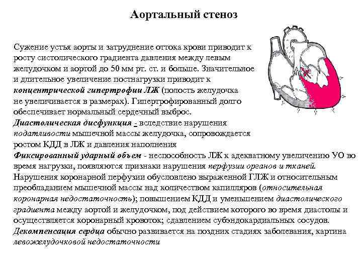 Аортальный стеноз Сужение устья аорты и затруднение оттока крови приводит к росту систолического градиента