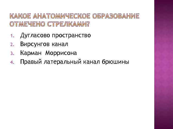 1. 2. 3. 4. Дугласово пространство Вирсунгов канал Карман Моррисона Правый латеральный канал брюшины