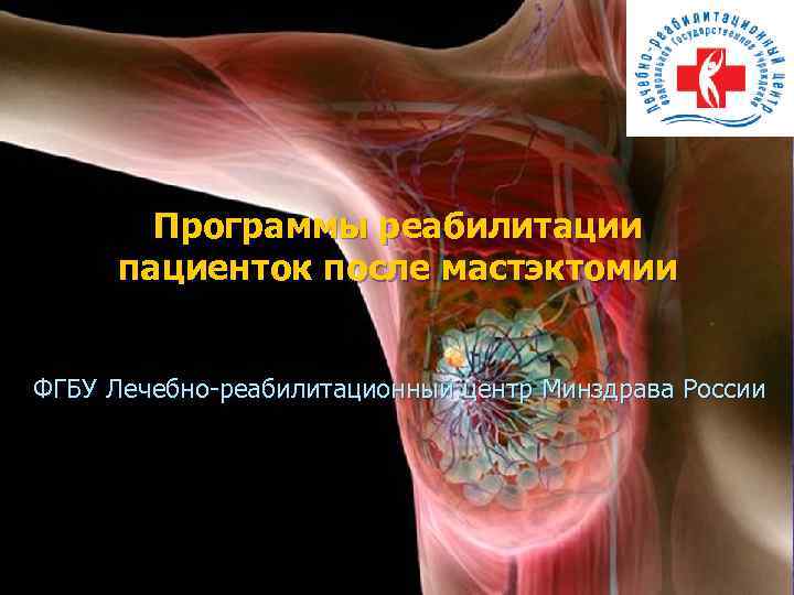 Программы реабилитации пациенток после мастэктомии ФГБУ Лечебно-реабилитационный центр Минздрава России 