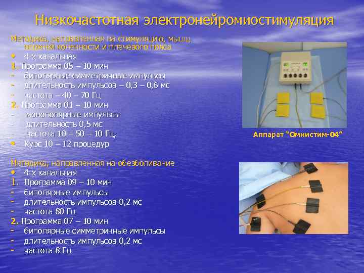Низкочастотная электронейромиостимуляция Методика, направленная на стимуляцию, мышц верхней конечности и плечевого пояса • 4